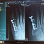 #Roentgen #Pazientenakte